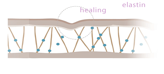 step-2-plasma-fibroblast.png-image